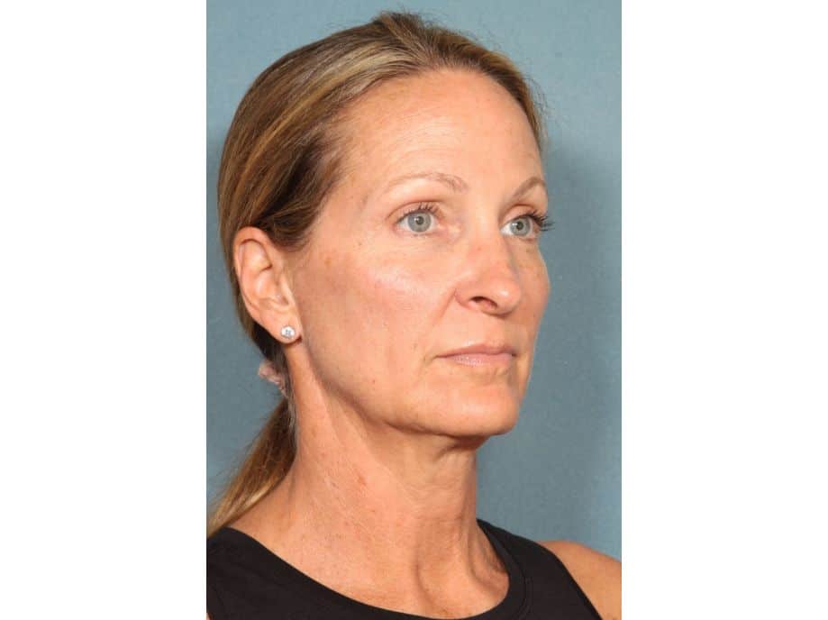 Three-quarter portrait of a middle-aged woman with hair pulled back, wearing stud earrings and a black top