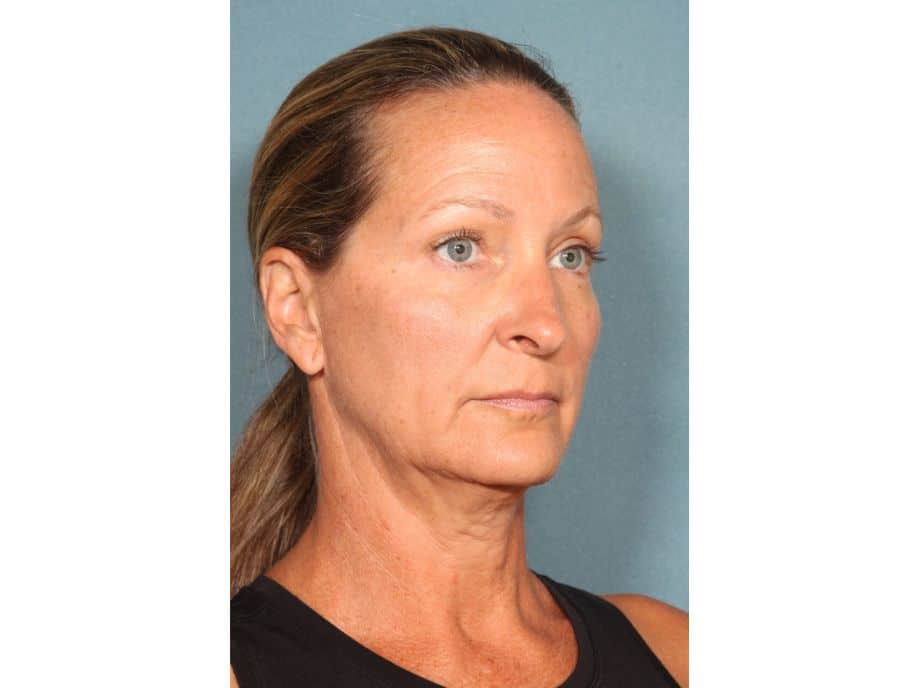 A woman with hair pulled back in a black tank top, neutral expression, looking right against a blue background
