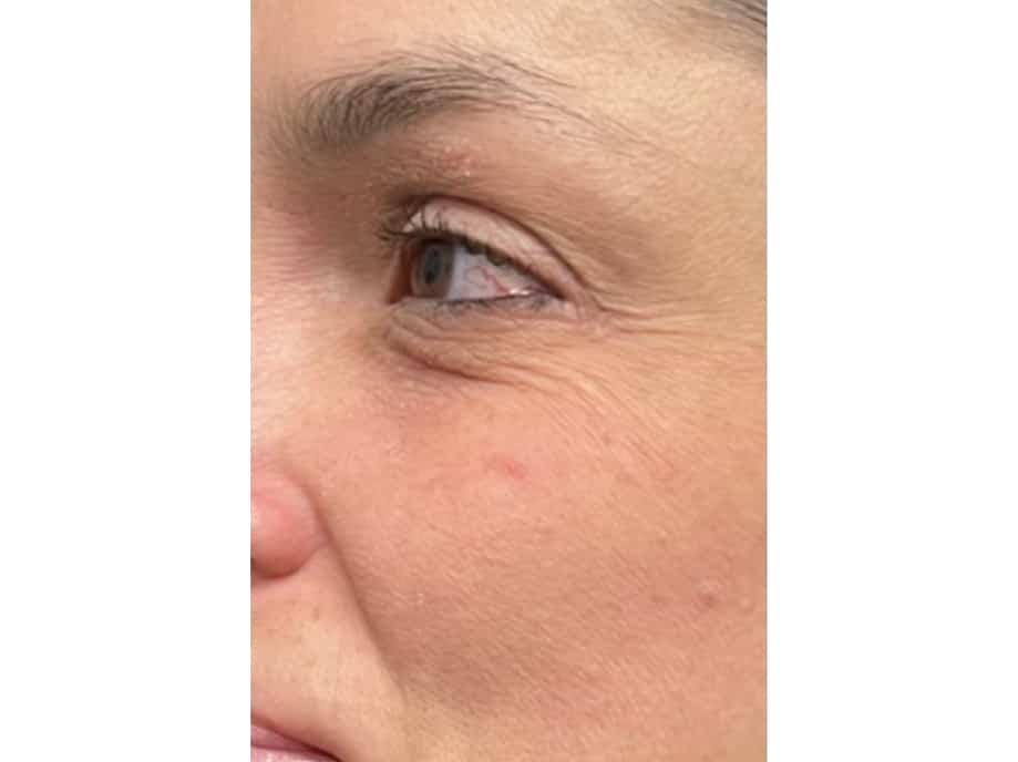 Close-up of a woman's eye and cheek showing crow's feet, fine lines, pores, and skin texture